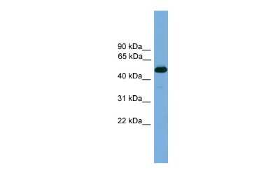 Western Blot: TR beta 1/NR1A2/Thyroid Hormone Receptor beta Antibody [NBP3-10413]